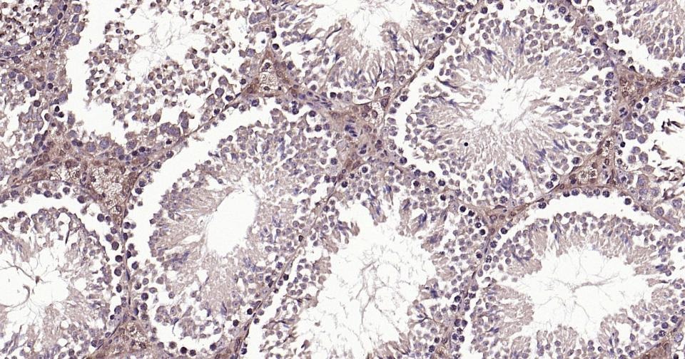 Beta-Tubulin Loading Control Polyclonal Antibody