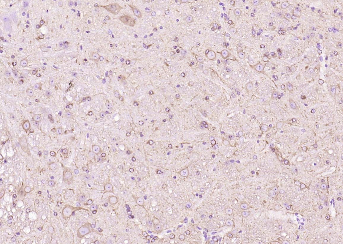 Beta-Tubulin Loading Control Antibody (8M945)