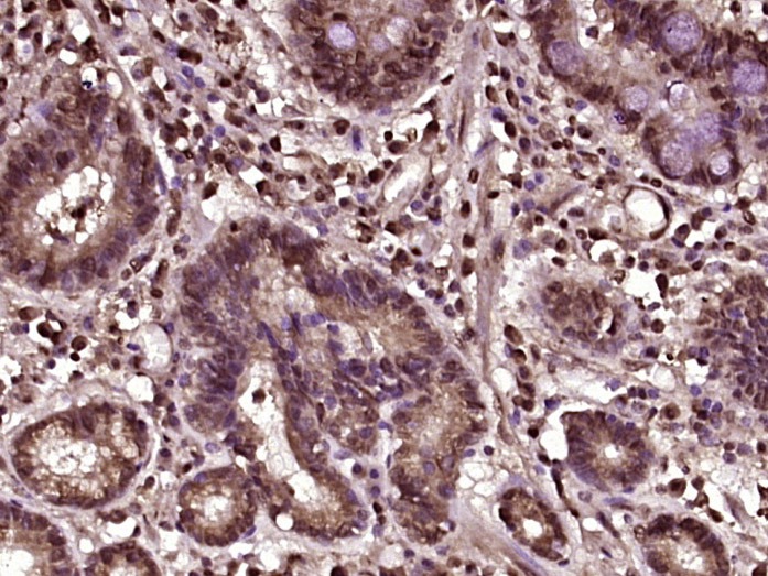 Anti-Beta-Catenin Polyclonal Antibody 2