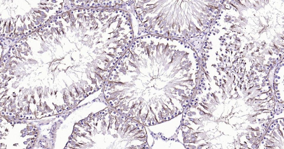 Beta-Tubulin Loading Control Antibody (8M945)