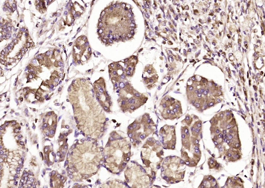 Anti-AHR Polyclonal Antibody 2
