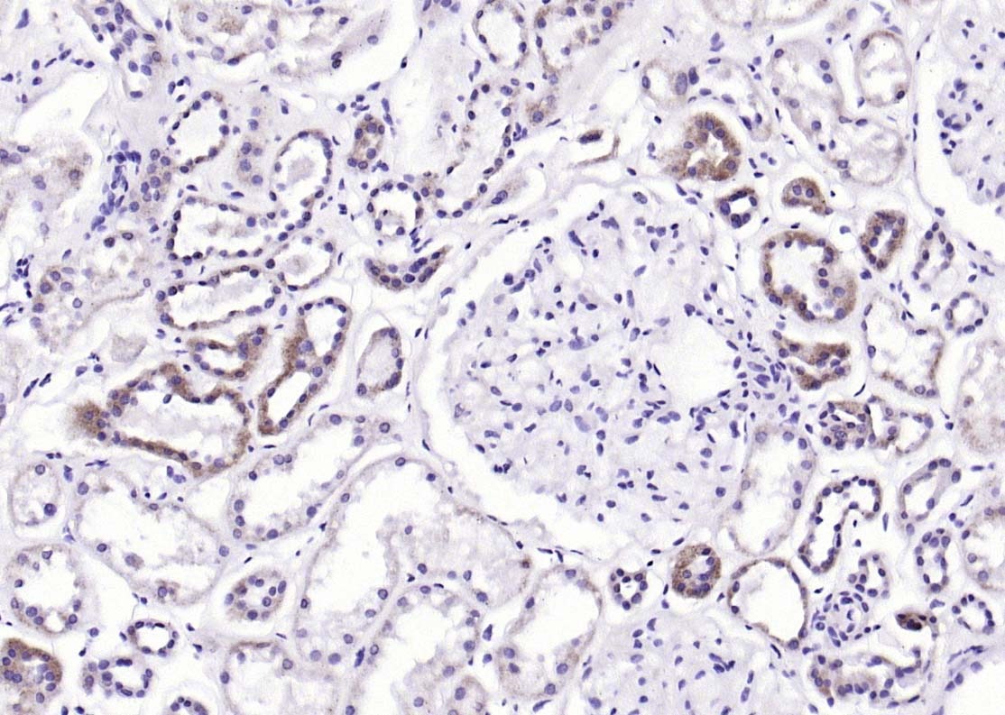 Anti-AKT1/2/3 Polyclonal Antibody