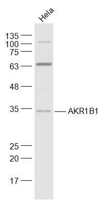 Anti-AKR1B1 Polyclonal Antibody