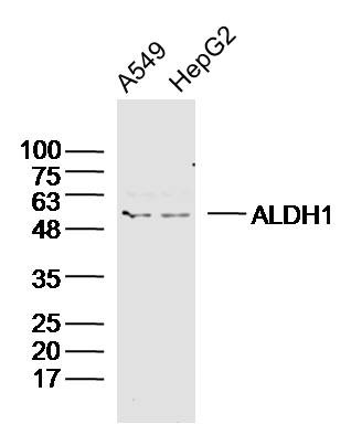 Anti-ALDH1A1 Polyclonal Antibody