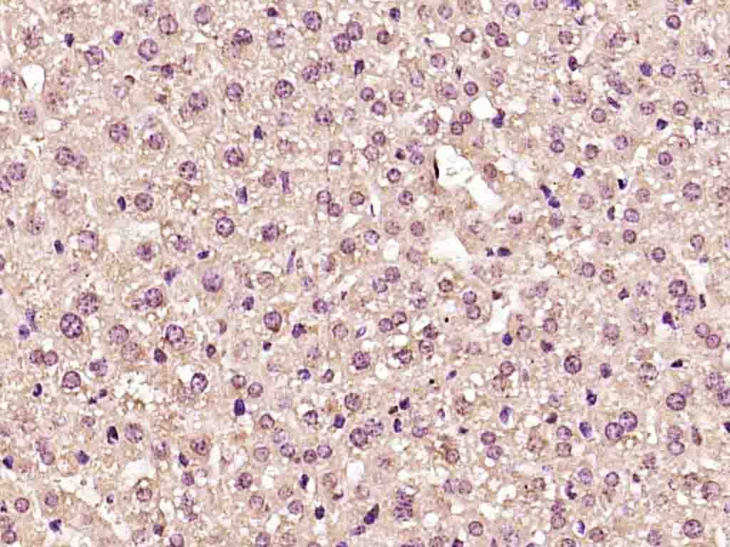 Anti-AKT1 Polyclonal Antibody