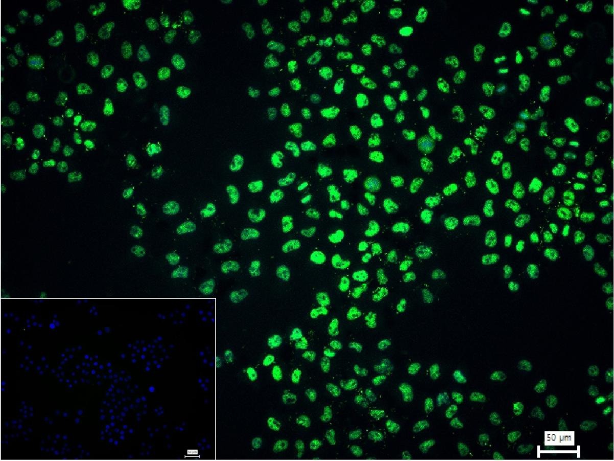 Anti-AKT1 Antibody (2U423)