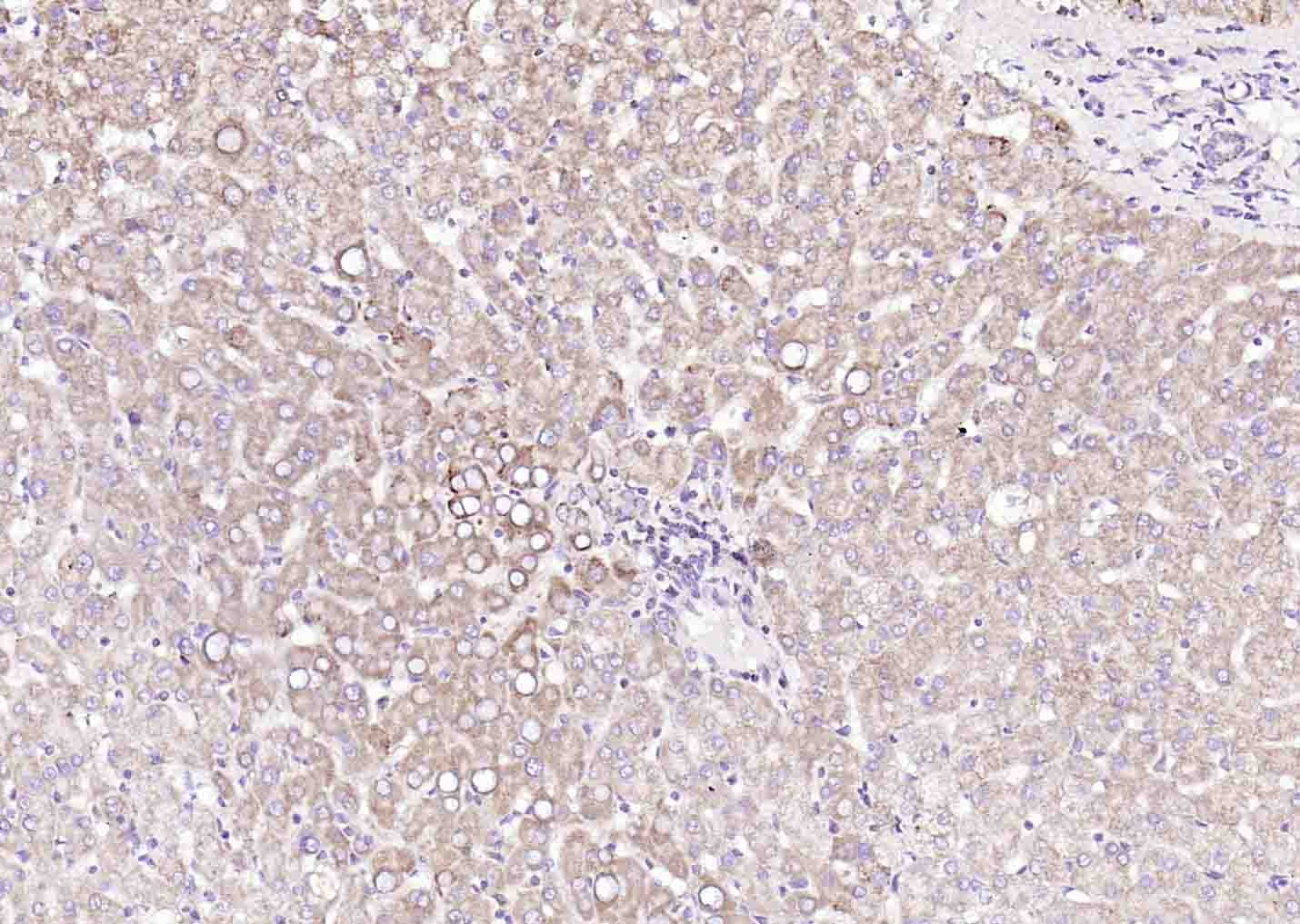 Anti-ANGPTL4 Polyclonal Antibody