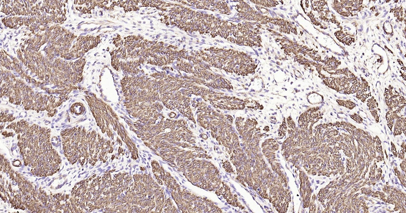 Anti-ACTA2 Antibody (1T673)