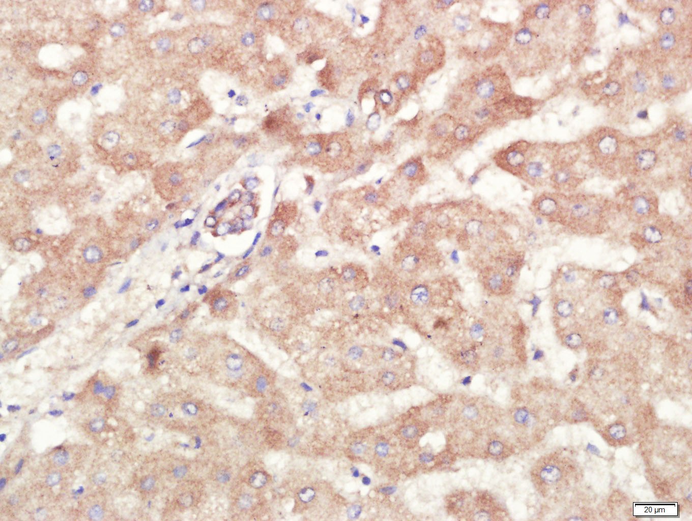 Anti-ALDH1A1 Polyclonal Antibody
