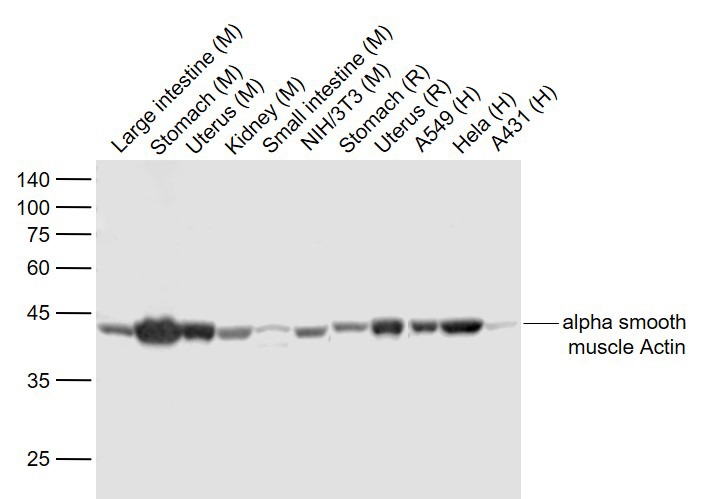 Anti-ACTA2 Antibody (1T673)