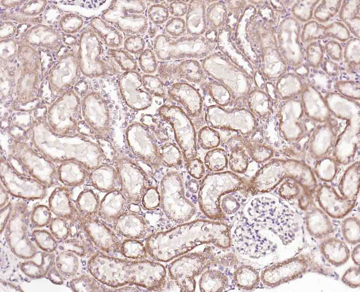 Anti-ANGPTL4 Polyclonal Antibody