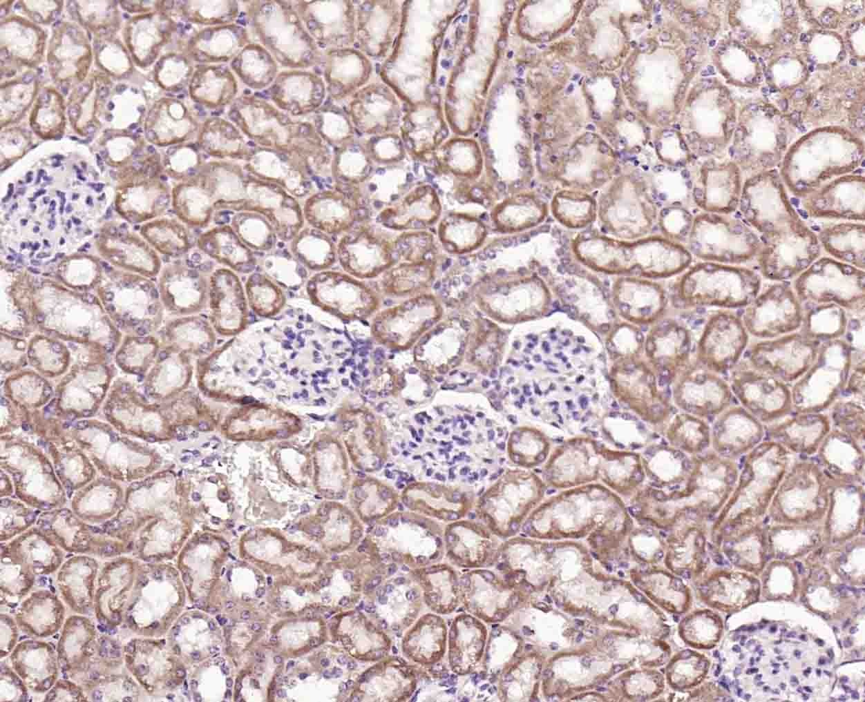 Anti-ANGPTL4 Polyclonal Antibody