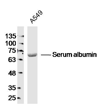 Anti-Albumin Polyclonal Antibody