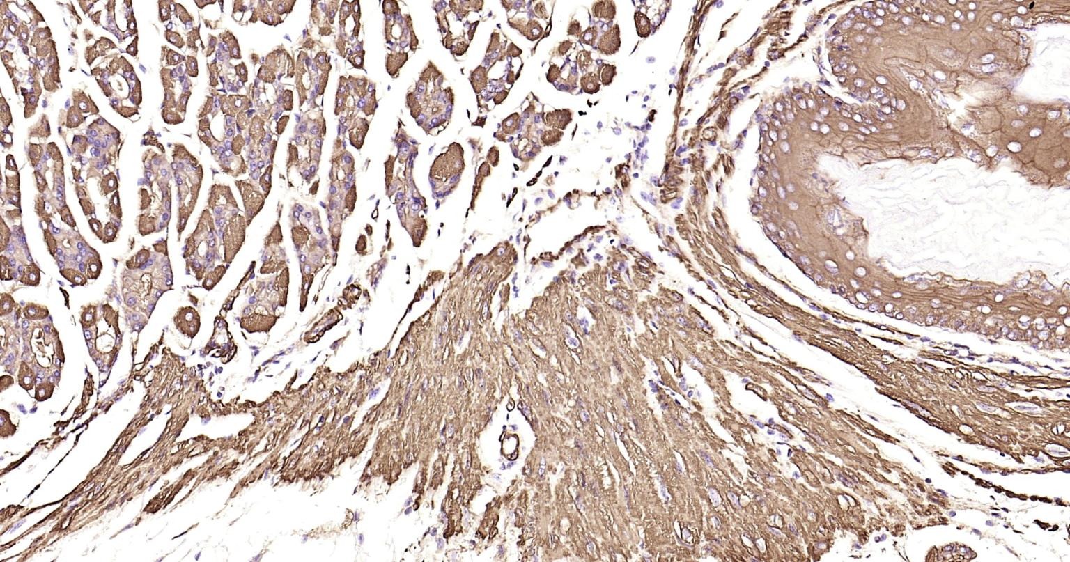 Anti-ACTA2 Antibody (1T673)