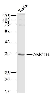 Anti-AKR1B1 Polyclonal Antibody