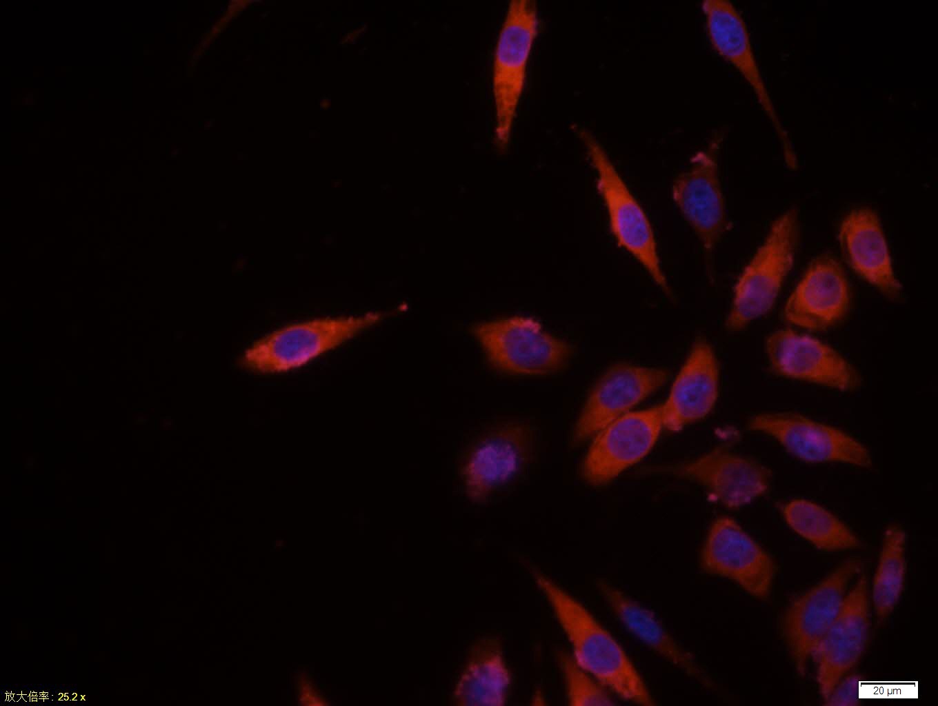 Anti-AKT1 Polyclonal Antibody