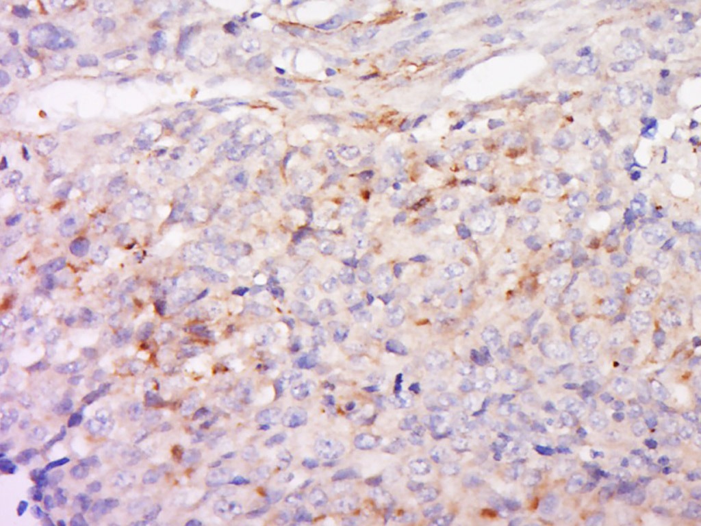 Anti-ANGPT2/Angiopoietin-2 Polyclonal Antibody
