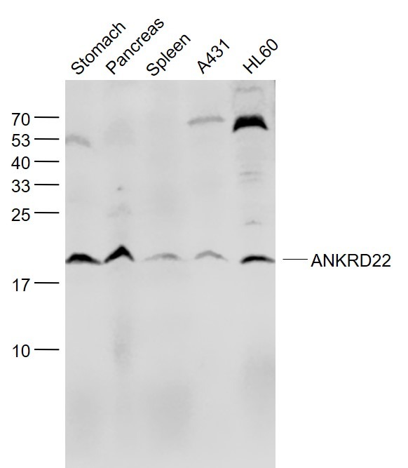 Anti-ANKRD22 Polyclonal Antibody