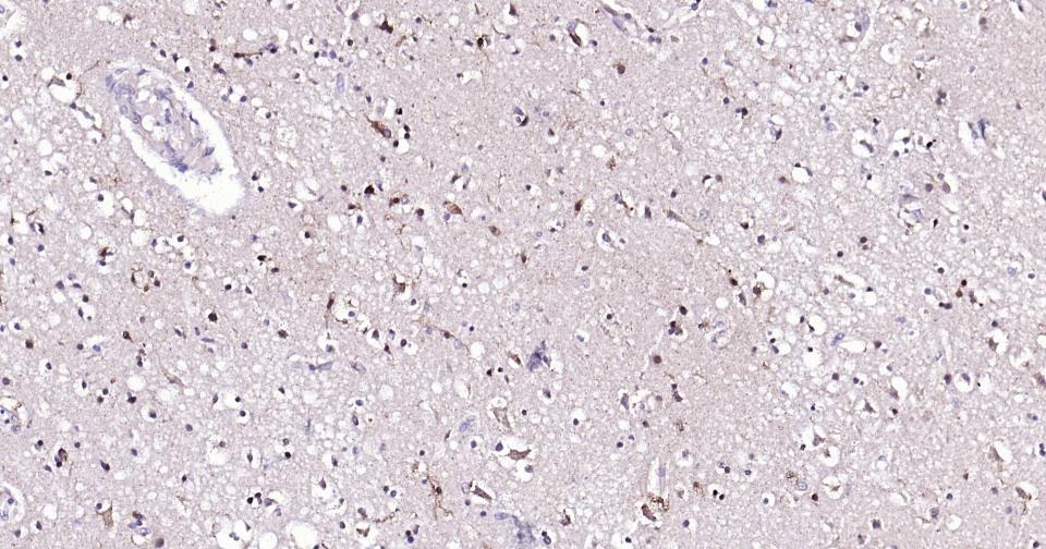 Anti-AKT1 Antibody (2U423)