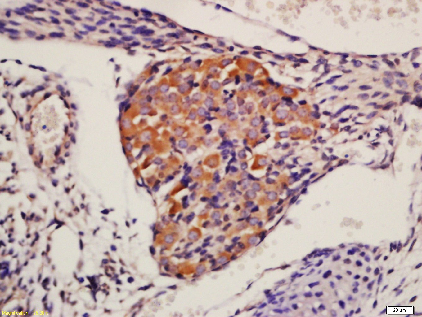 Anti-AKT1/2/3 Polyclonal Antibody
