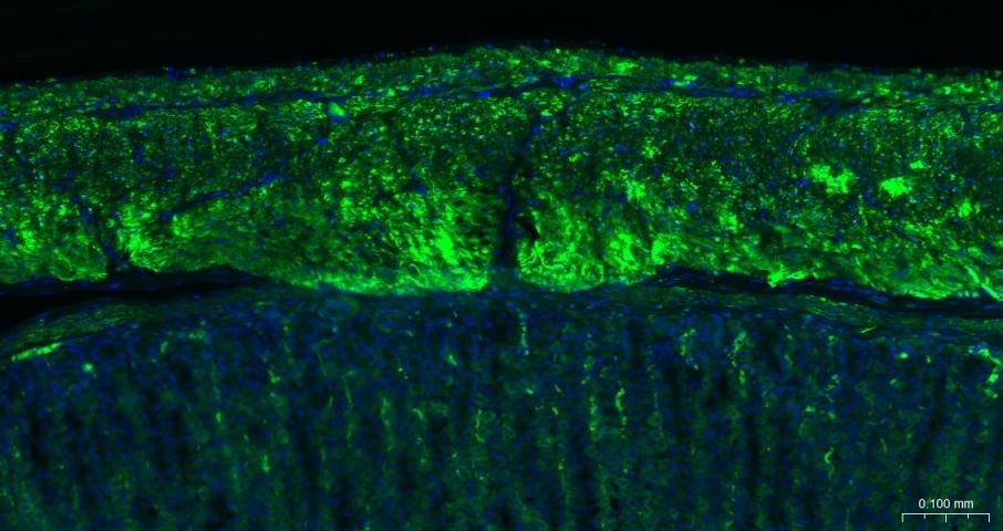 Anti-ACTA2 Antibody (1T673)