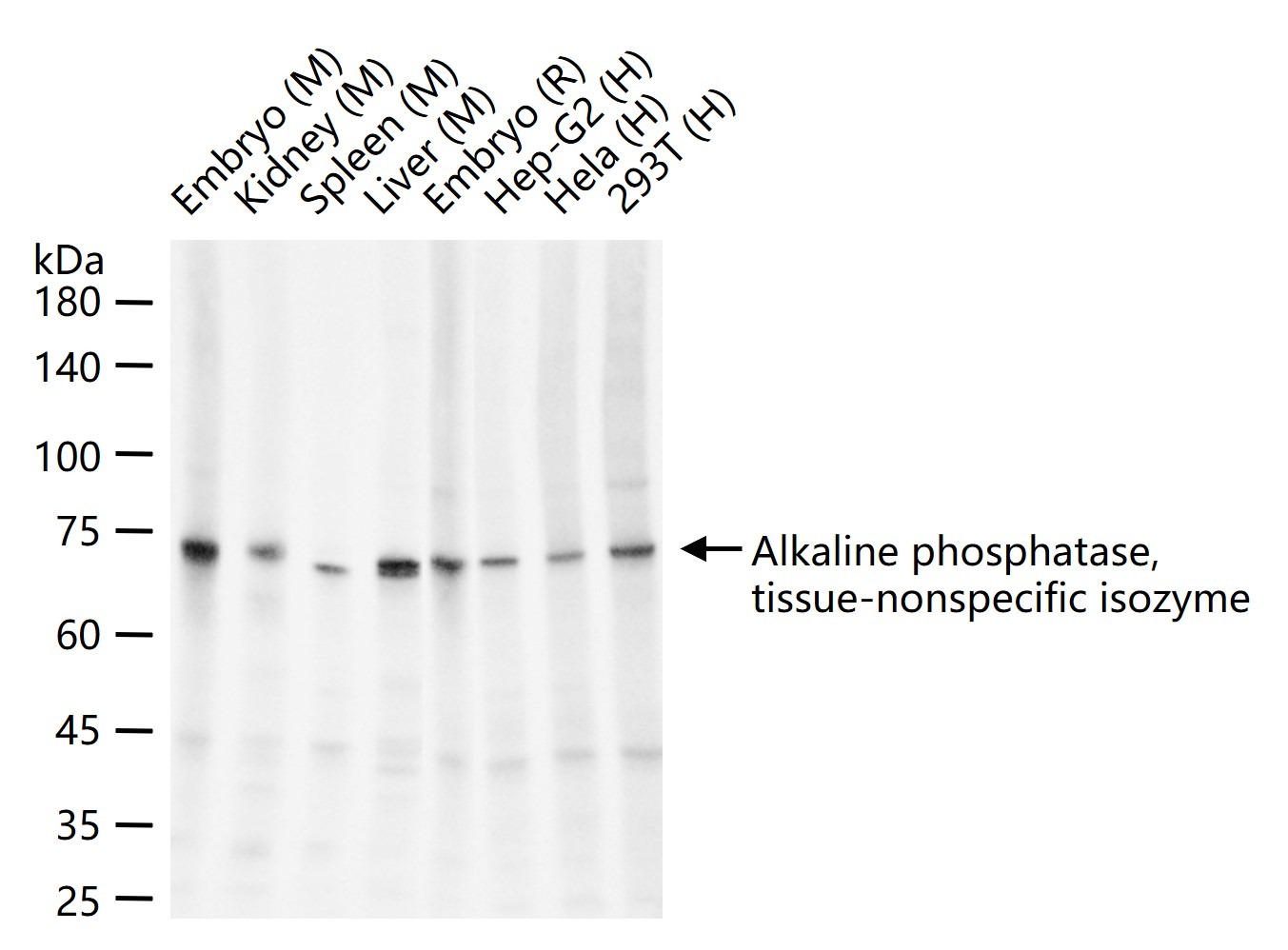 Anti-Alkaline Phosphatase/ALPL Antibody (4R389)
