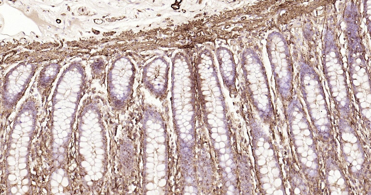 Anti-ACTA2 Antibody (1T673)