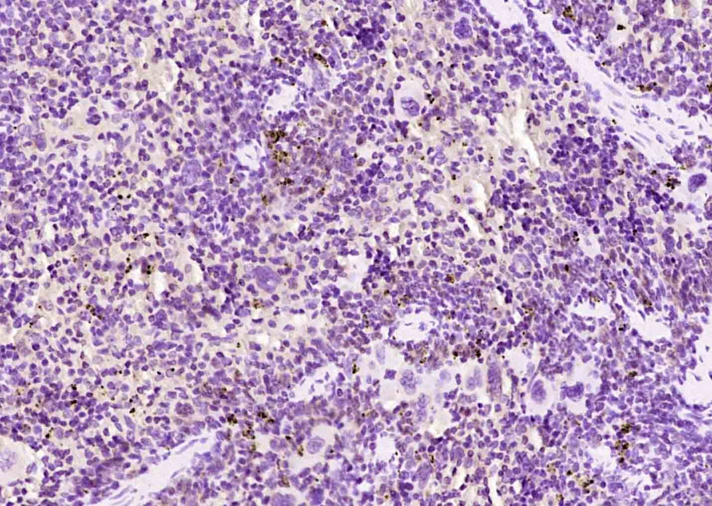 Anti-AIM2 Polyclonal Antibody