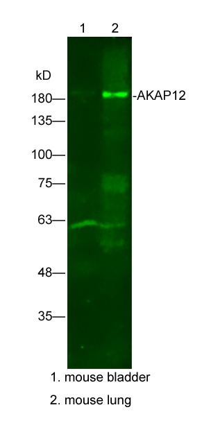 Anti-AKAP12 Polyclonal Antibody