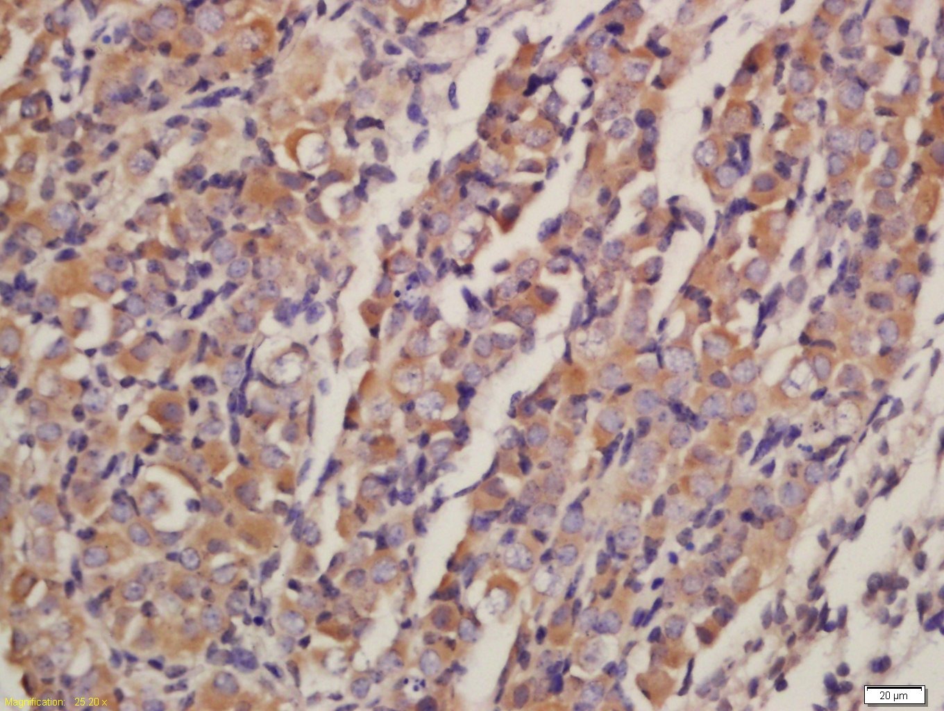 Anti-AKT1/2/3 Polyclonal Antibody
