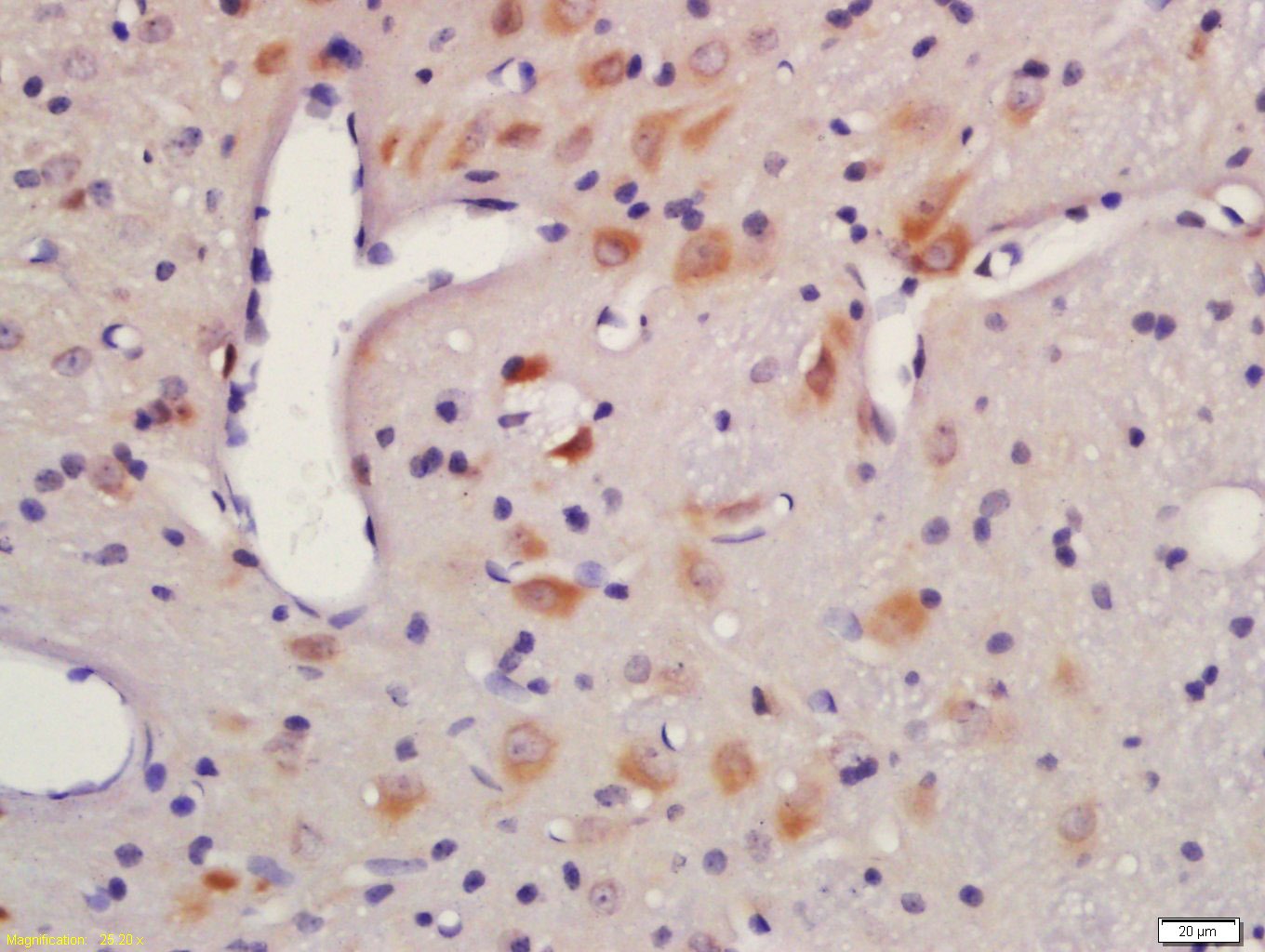 Anti-AKT1/2/3 Polyclonal Antibody