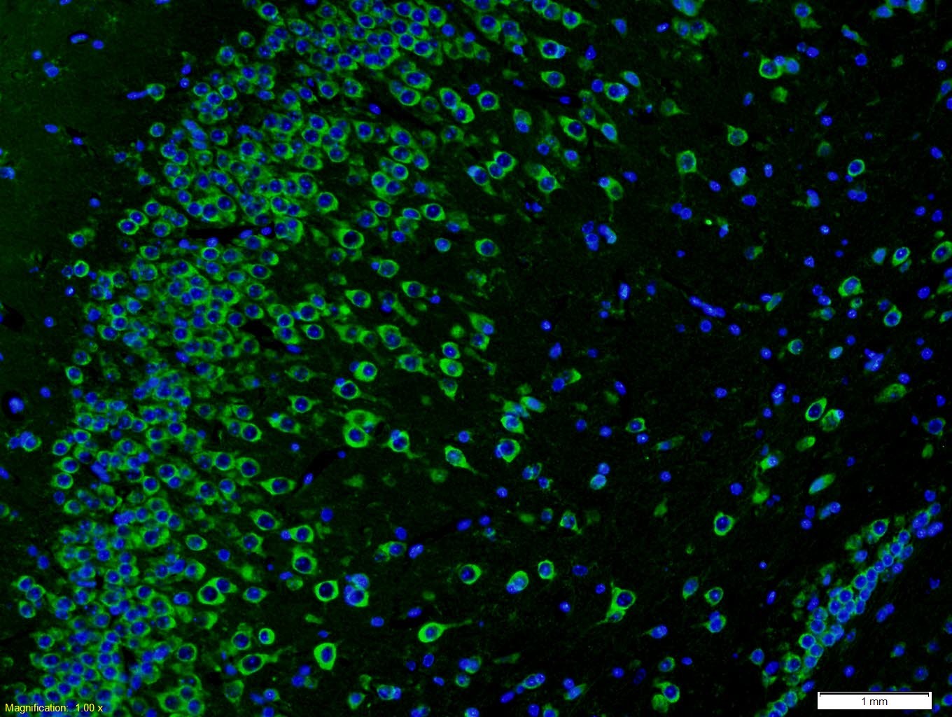Anti-AKAP12 Polyclonal Antibody