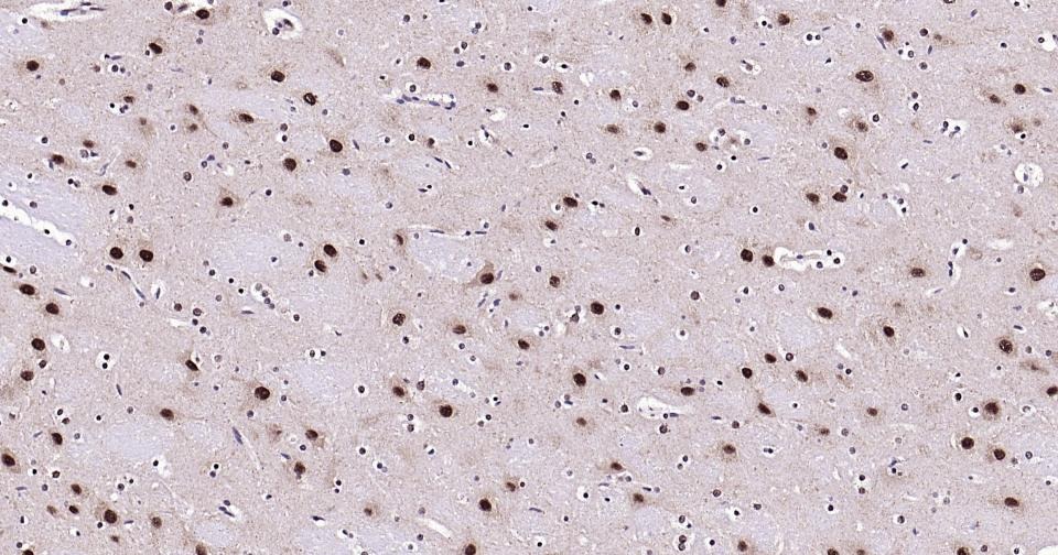 Anti-AKT1 Antibody (2U423)