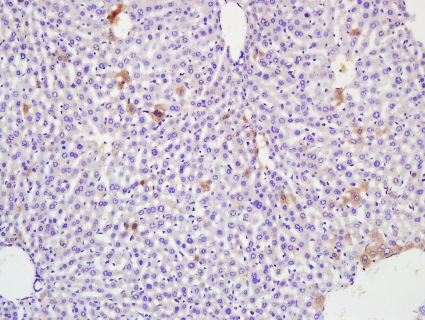 Anti-Albumin Polyclonal Antibody