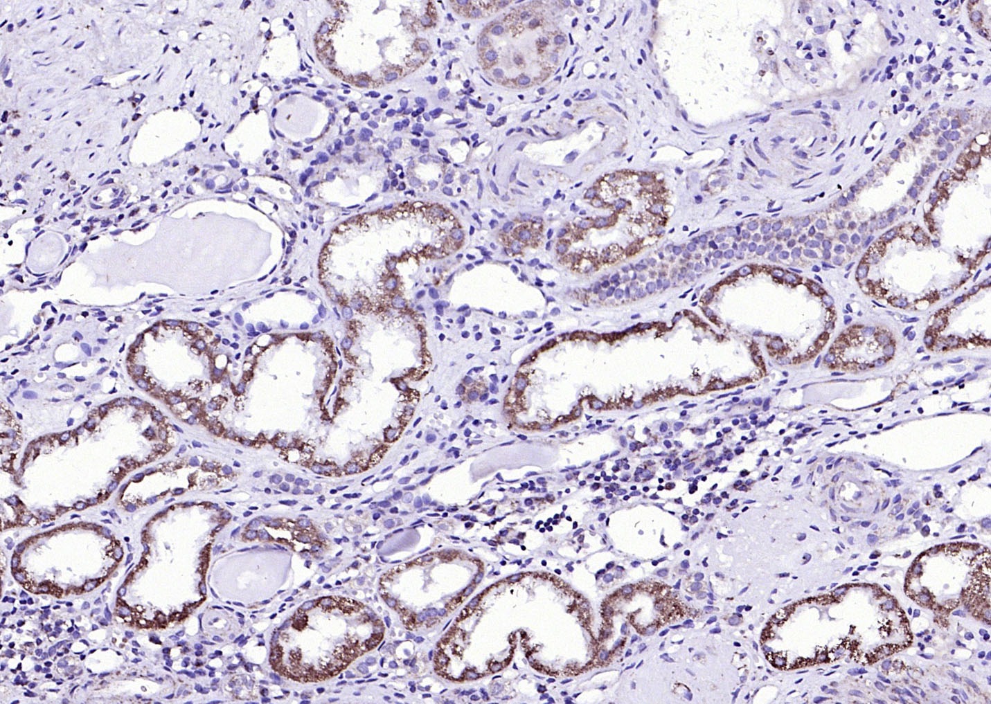 Anti-ACVR2B Polyclonal Antibody