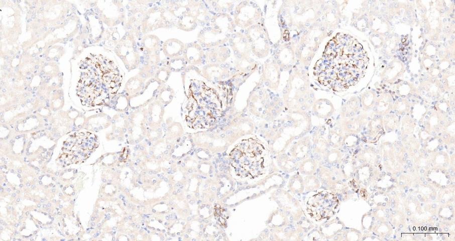 Anti-ADAM17 Polyclonal Antibody