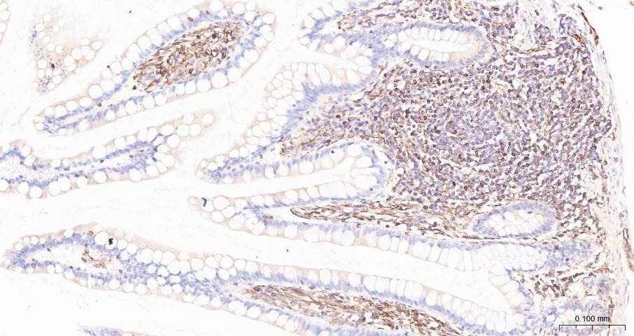 Anti-ADAM17 Polyclonal Antibody