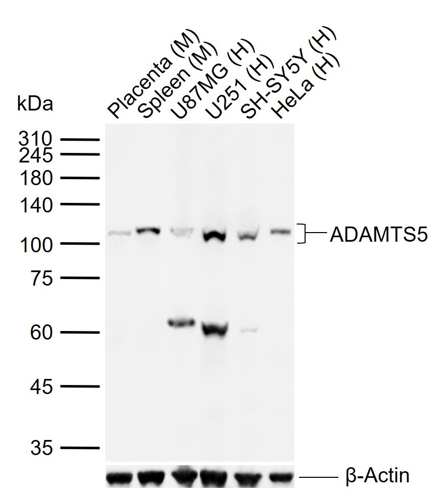 Anti-ADAMTS5 Polyclonal Antibody