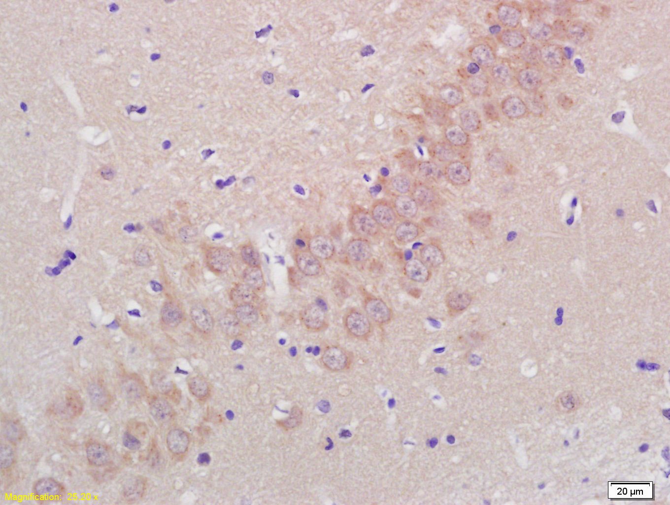 Anti-ADAMTS5 Polyclonal Antibody