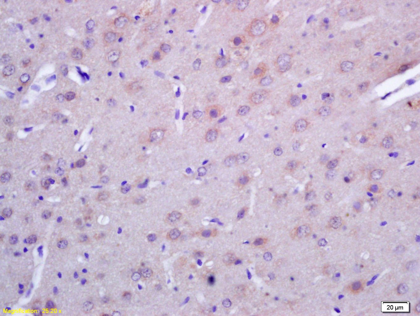 Anti-ACTH (1-39) Polyclonal Antibody