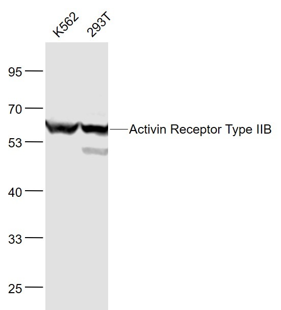 Anti-ACVR2B Polyclonal Antibody