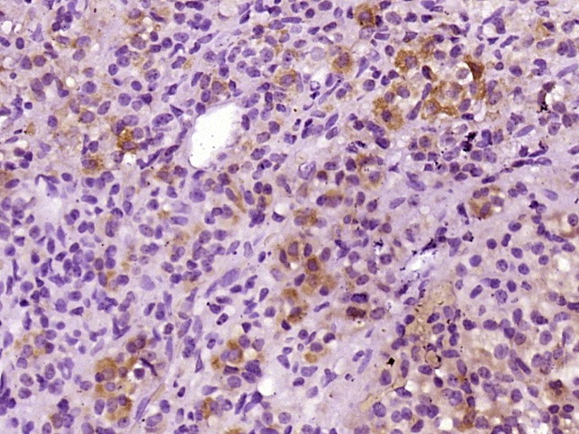 Anti-ACTH (1-39) Polyclonal Antibody