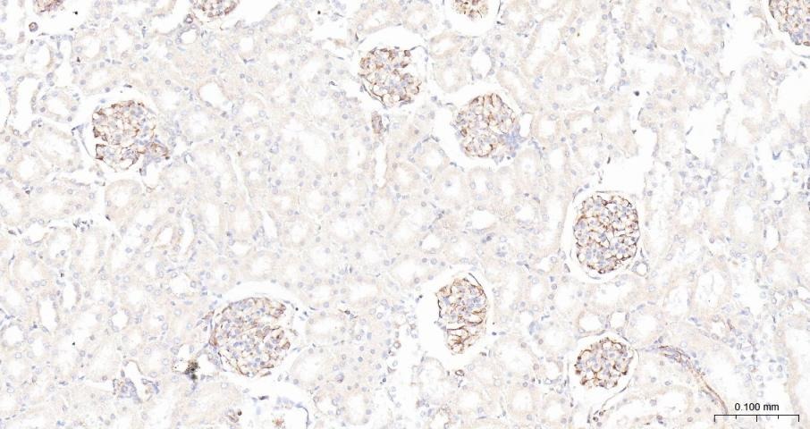 Anti-ADAM17 Polyclonal Antibody