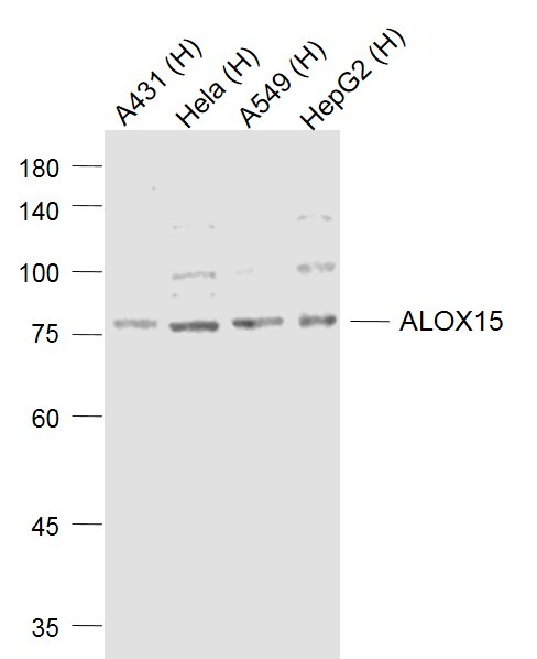 Anti-ALOX15 Polyclonal Antibody 2