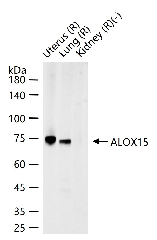 Anti-ALOX15 Polyclonal Antibody
