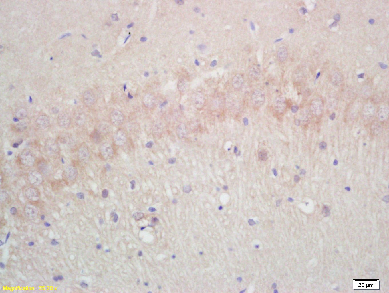 Anti-Aquaporin-4/AQP4 Polyclonal Antibody