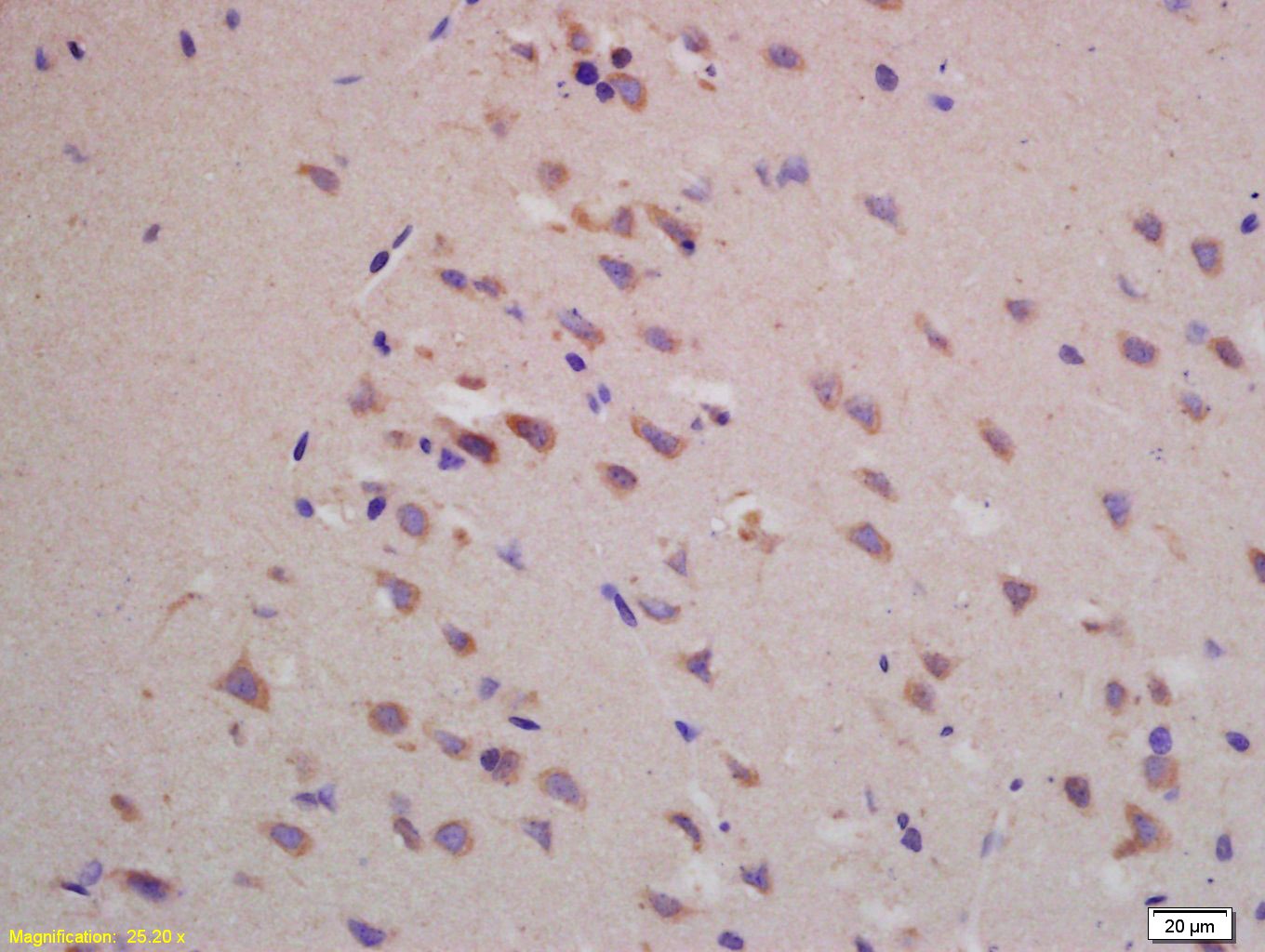 Anti-BACE1 Polyclonal Antibody