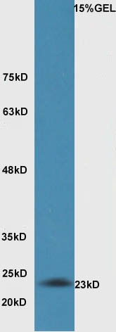 Anti-BAK1 Polyclonal Antibody