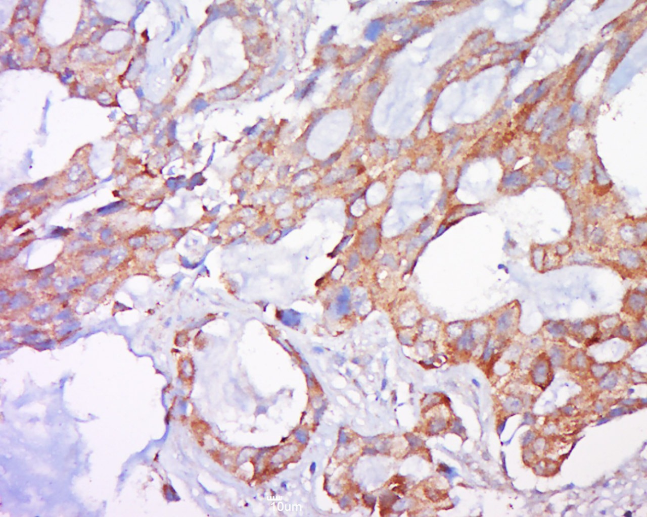 Anti-BAK1 Polyclonal Antibody