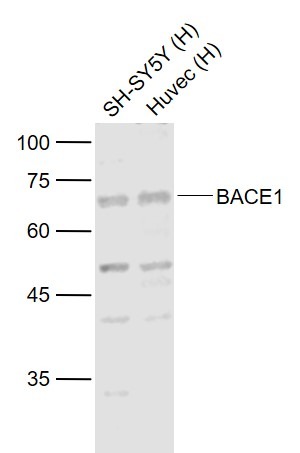 Anti-BACE1 Polyclonal Antibody